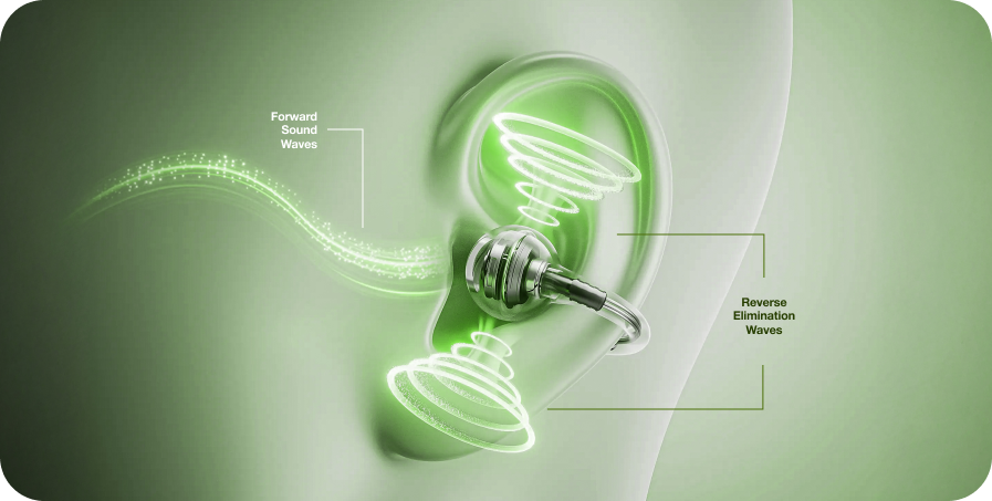 Open Sound, Directed Clarity